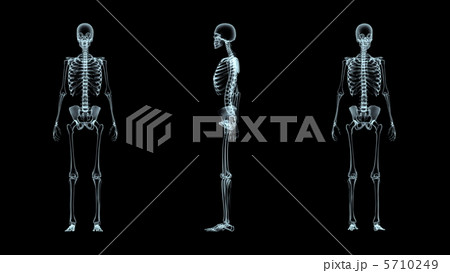 レントゲン写真 全身 X線のイラスト素材 - PIXTA
