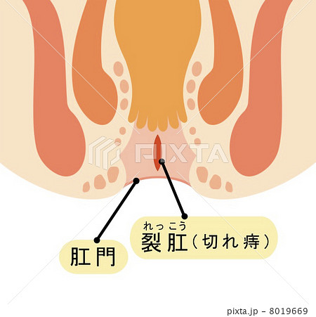 傷口のイラスト素材