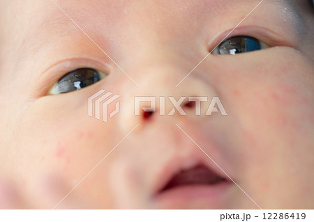 黄疸の写真素材