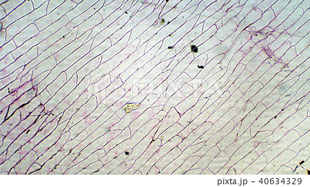 人気ダウンロード タマネギ 表皮 細胞 タマネギ 表皮 細胞膜