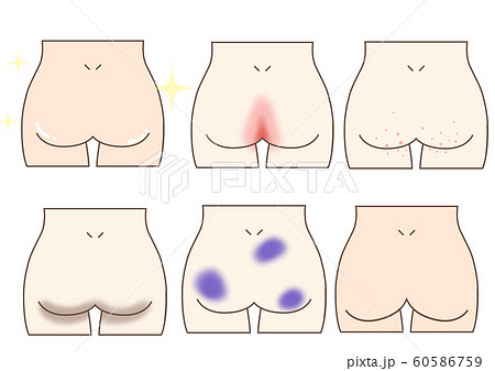 おしりのイラスト素材