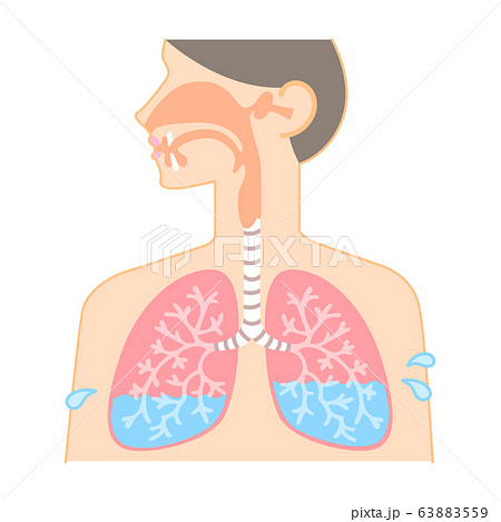 肺水腫のイラスト素材