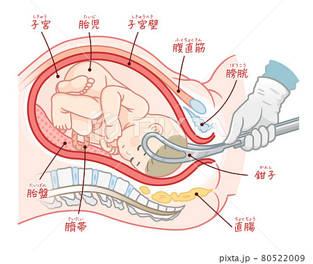 胎盤のイラスト素材