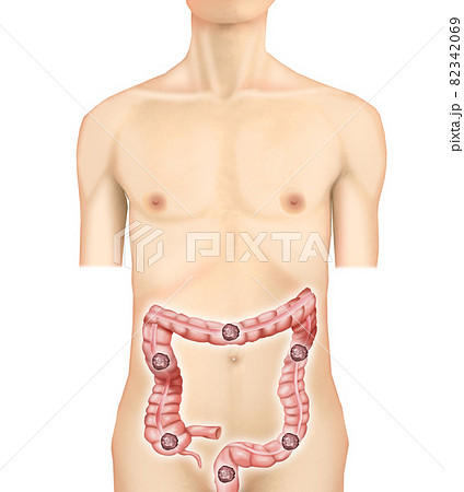 大腸のイラスト素材