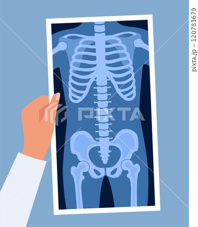 レントゲン写真 診察室 診察 骨盤の写真素材 - PIXTA